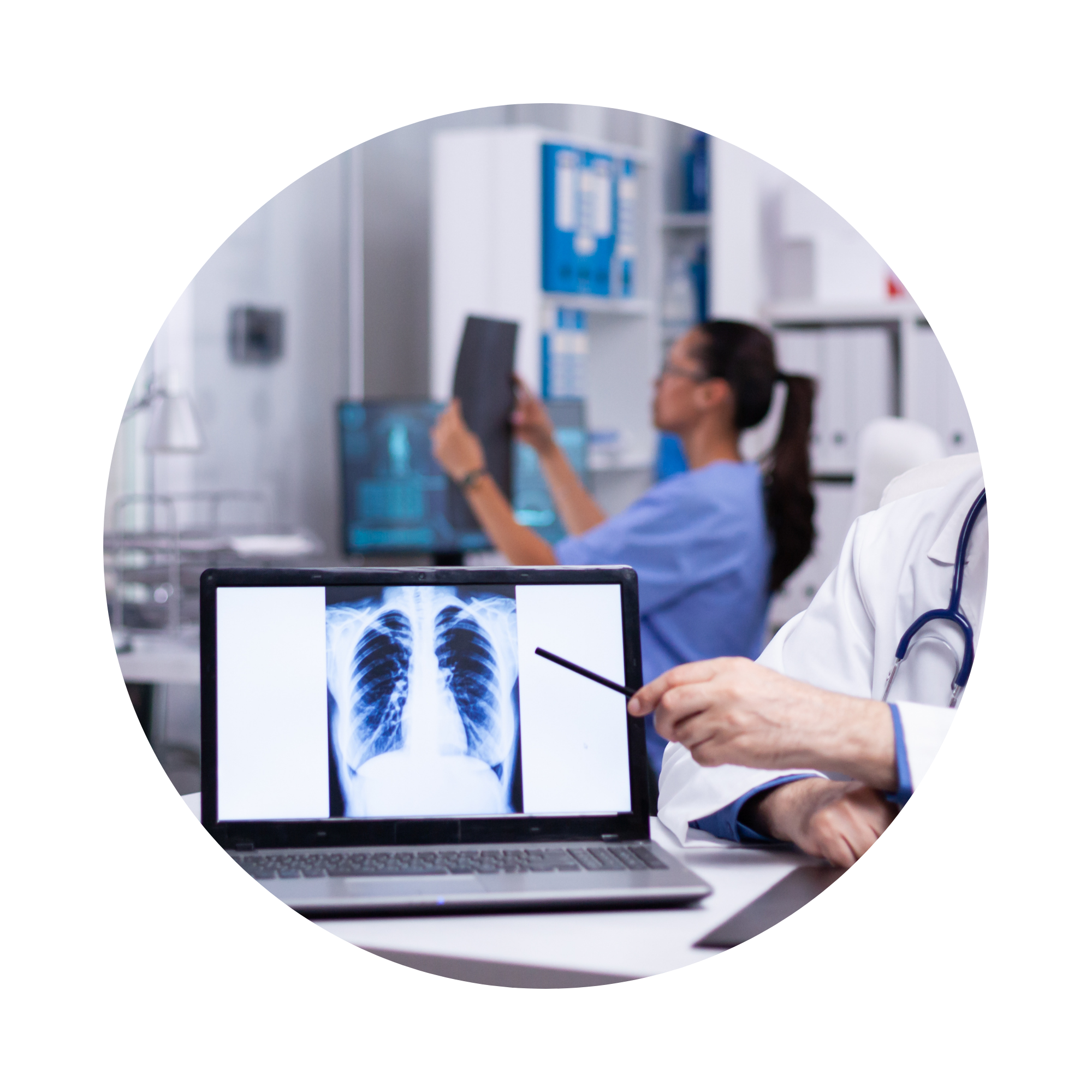 Reducing False Negatives in Early Lung Cancer Detection Using Machine Learning-Based Analysis of Pulmonary Imaging Patterns